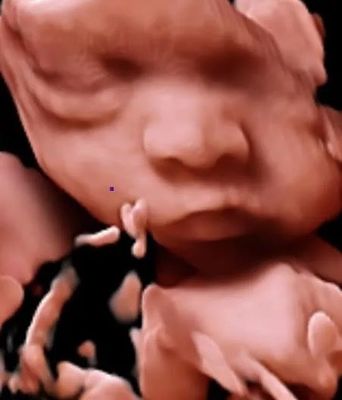 OB GYN के लिए 3D 4D 5D रंग डॉपलर अल्ट्रासाउंड ट्रॉली अल्ट्रासाउंड स्कैनर